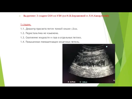 Выделяют 3 стадии СКН по УЗИ (по И.В.Берзаковой и Л.Н.Какаулиной) 1 стадия. 1.1.