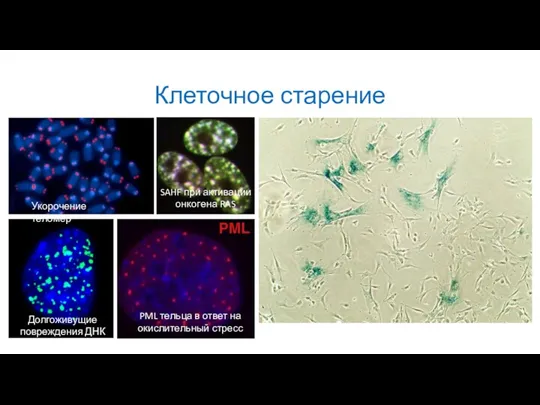 Клеточное старение Укорочение теломер Долгоживущие повреждения ДНК PML тельца в