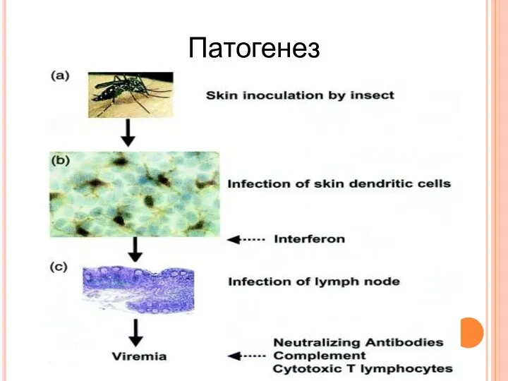 Патогенез