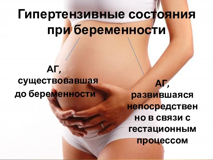 Гипертензивные состояния при беременности АГ, существовавшая до беременности АГ, развившаяся непосредственно в связи с гестационным процессом