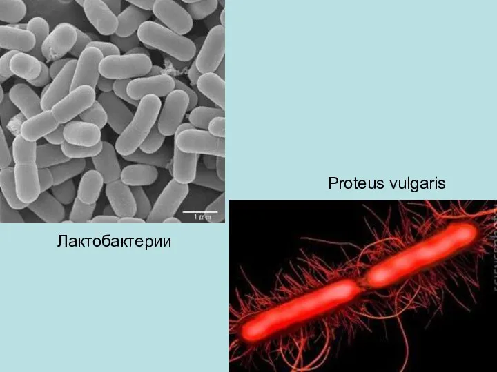 Proteus vulgaris Лактобактерии