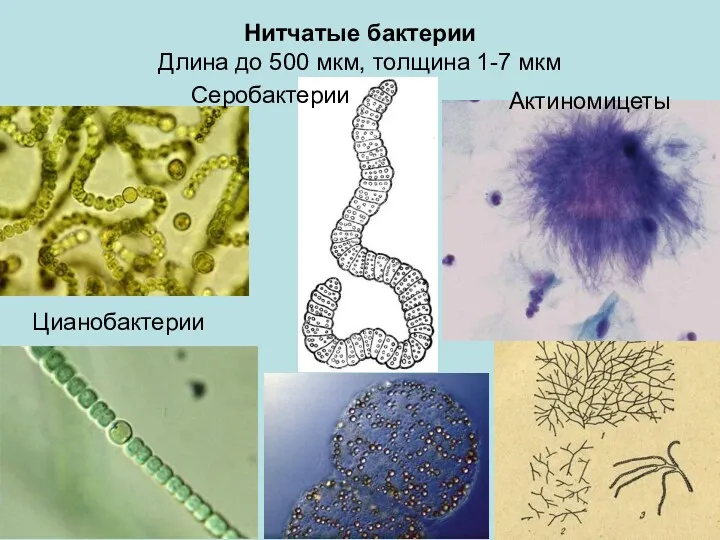 Нитчатые бактерии Длина до 500 мкм, толщина 1-7 мкм Цианобактерии Серобактерии Актиномицеты