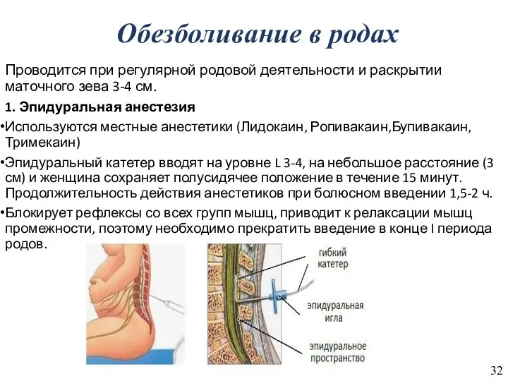 Обезболивание в родах Проводится при регулярной родовой деятельности и раскрытии