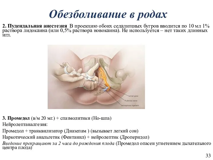 Обезболивание в родах 2. Пудендальная анестезия В проекцию обоих седалищных