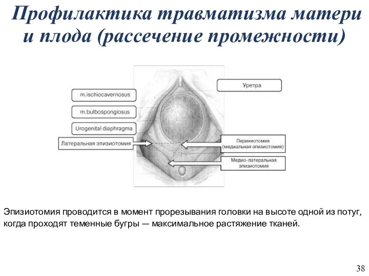 Профилактика травматизма матери и плода (рассечение промежности) Эпизиотомия проводится в