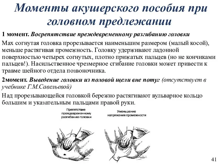 Моменты акушерского пособия при головном предлежании 1 момент. Восрепятствие преждевременному