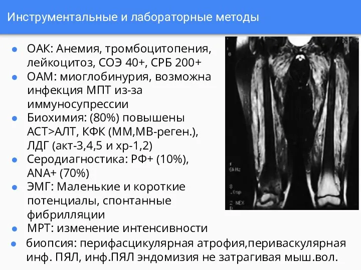 Инструментальные и лабораторные методы ОАК: Анемия, тромбоцитопения, лейкоцитоз, СОЭ 40+,