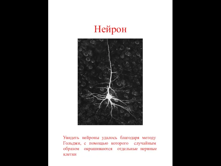Нейрон Увидеть нейроны удалось благодаря методу Гольджи, с помощью которого случайным образом окрашиваются отдельные нервные клетки