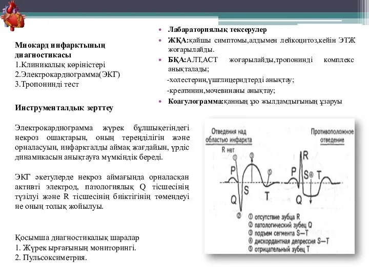 Лабараториялық тексерулер ЖҚА:қайшы симптомы,алдымен лейкоцитоз,кейін ЭТЖ жоғарылайды. БҚА:АЛТ,АСТ жоғарылайды,тропонинді комплекс