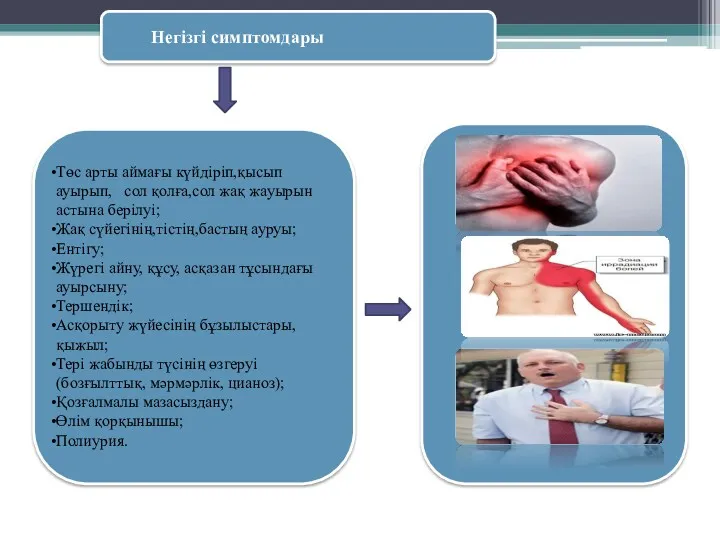 Негізгі симптомдары Төс арты аймағы күйдіріп,қысып ауырып, сол қолға,сол жақ