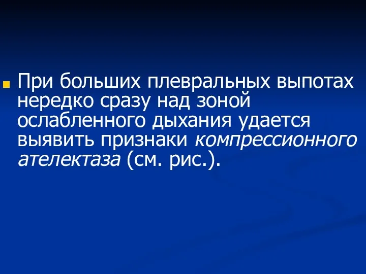 При больших плевральных выпотах нередко сразу над зоной ослабленного дыхания