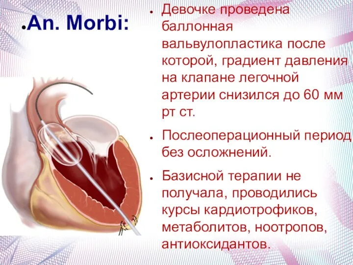 An. Morbi: Девочке проведена баллонная вальвулопластика после которой, градиент давления