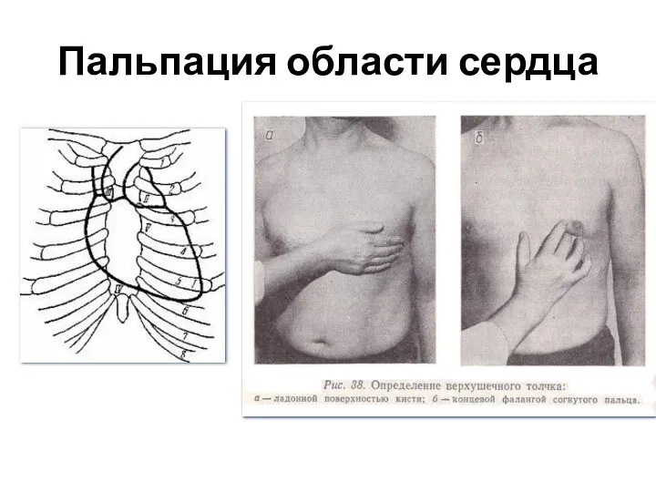 Пальпация области сердца