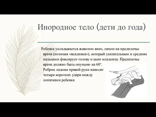 Инородное тело (дети до года) Ребенок укладывается животом вниз, лицом на предплечье врача