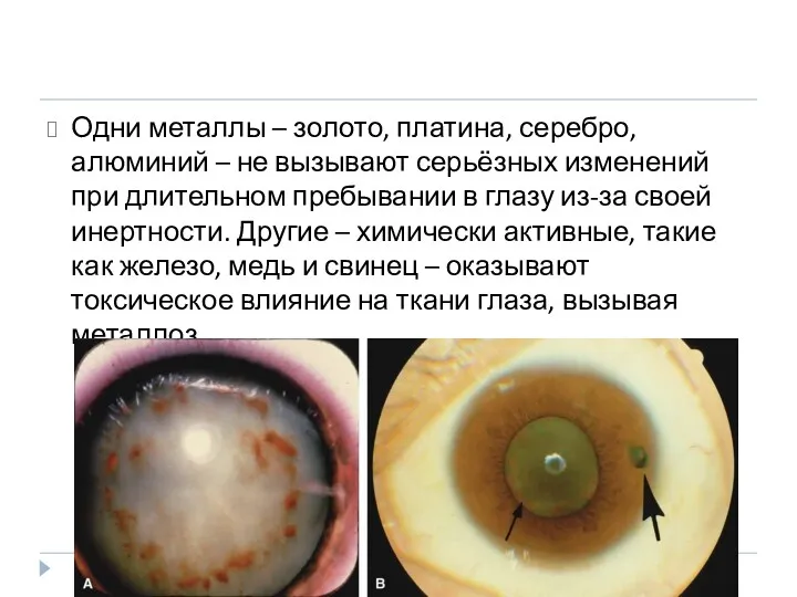 Одни металлы – золото, платина, серебро, алюминий – не вызывают