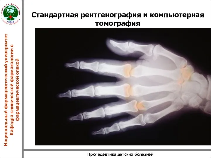 Пропедевтика детских болезней Стандартная рентгенография и компьютерная томография