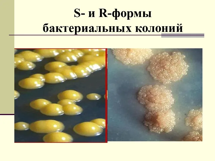 S- и R-формы бактериальных колоний