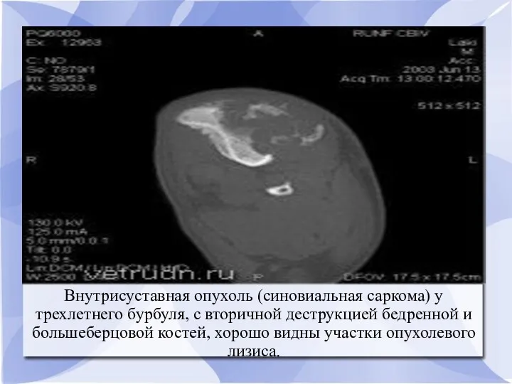 Внутрисуставная опухоль (синовиальная саркома) у трехлетнего бурбуля, с вторичной деструкцией