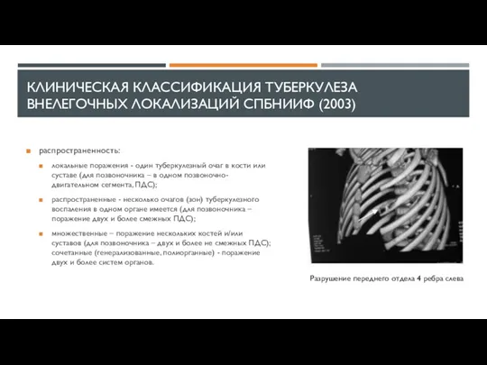 КЛИНИЧЕСКАЯ КЛАССИФИКАЦИЯ ТУБЕРКУЛЕЗА ВНЕЛЕГОЧНЫХ ЛОКАЛИЗАЦИЙ СПБНИИФ (2003) распространенность: локальные поражения