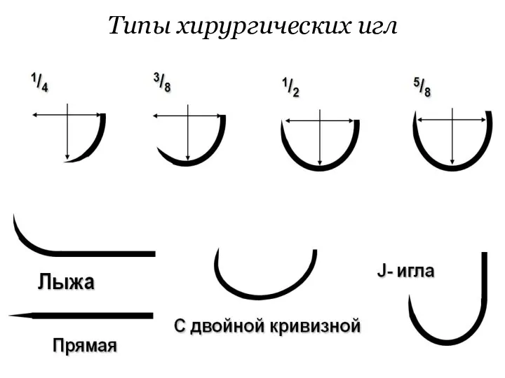 Типы хирургических игл