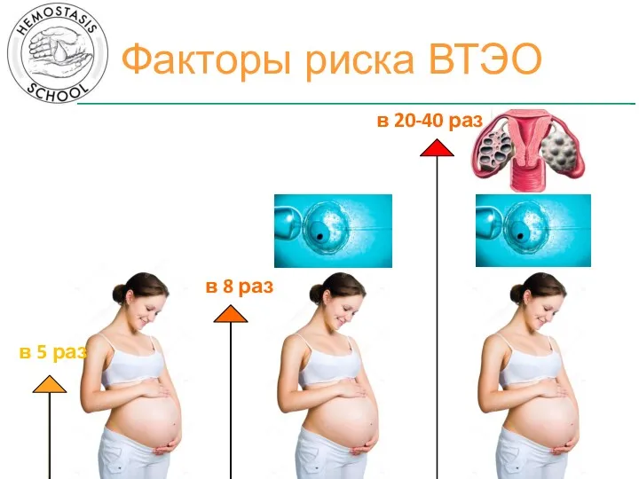 Факторы риска ВТЭО в 5 раз в 8 раз в 20-40 раз