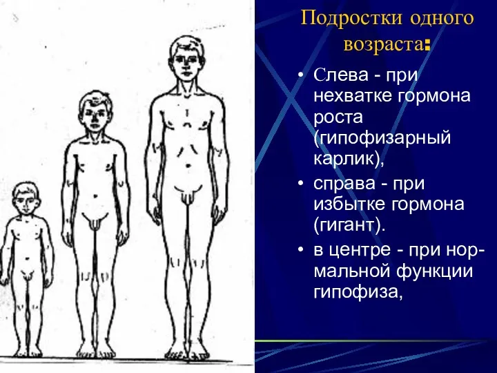 Подростки одного возраста: Слева - при нехватке гормона роста (гипофизарный
