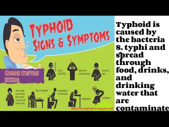 Typhoid is caused by the bacteria S. typhi and spread through food, drinks,