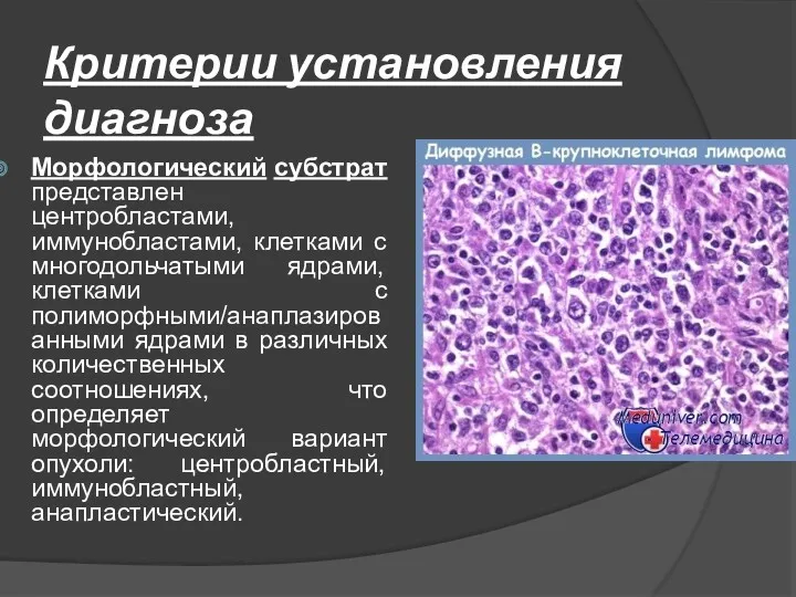 Критерии установления диагноза Морфологический субстрат представлен центробластами, иммунобластами, клетками с многодольчатыми ядрами, клетками