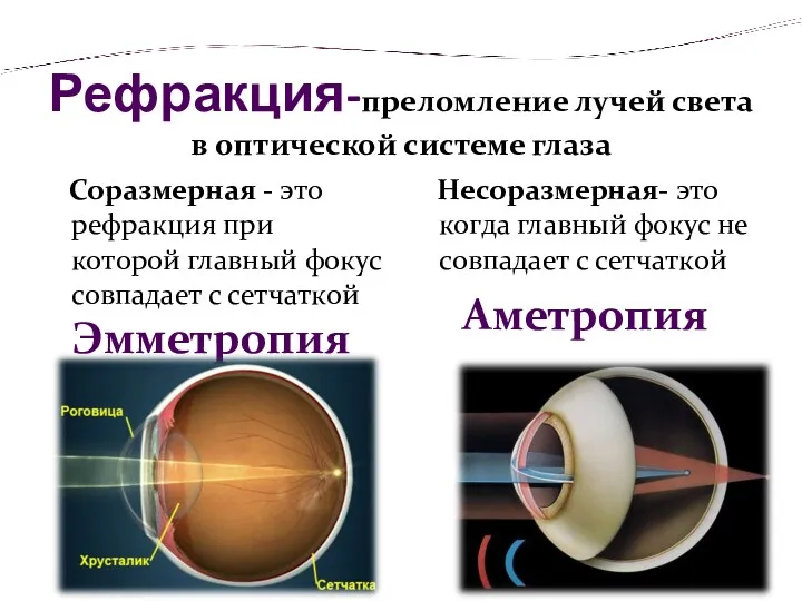 Рефракция-преломление лучей света в оптической системе глаза Соразмерная - это