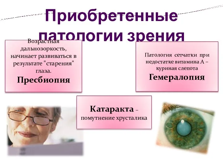 Приобретенные патологии зрения