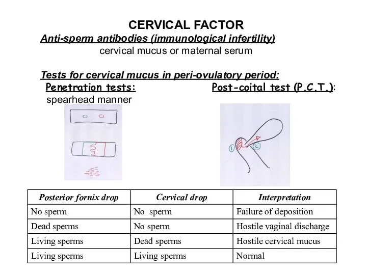 CERVICAL FACTOR Anti-sperm antibodies (immunological infertility) cervical mucus or maternal serum Tests for