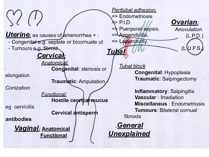 Ovarian: Anovulation (L.P.D.) (L.U.F.S.) Tubal Tubal block Congenital: Hypoplasia Traumatic: Salpingectomy Inflammatory: Salpingitis