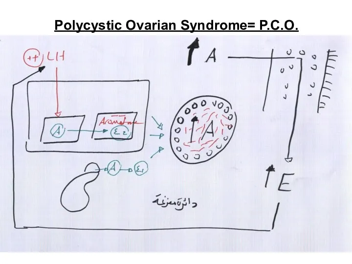 Polycystic Ovarian Syndrome= P.C.O.