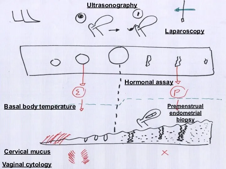 Ultrasonography Hormonal assay Premenstrual endometrial biopsy Laparoscopy Basal body temperature Cervical mucus Vaginal cytology