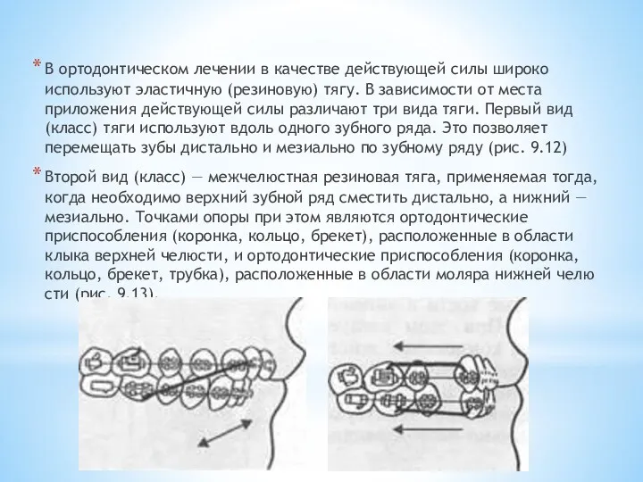 В ортодонтическом лечении в каче­стве действующей силы широко используют эластичную