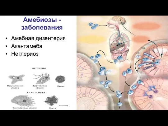 Амебиозы - заболевания Амебная дизентерия Акантамеба Неглериоз