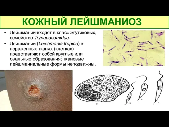 Лейшмании входят в класс жгутиковых, семейство Trypanosomidae. Лейшмании (Leishmania tropica)