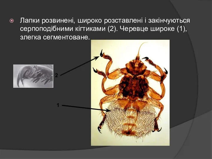 Лапки розвинені, широко розставлені і закінчуються серпоподібними кігтиками (2). Черевце широке (1), злегка сегментоване. 1 2