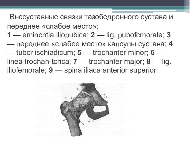 . Внссуставные связки тазобедренного сустава и переднее «слабое место»: 1