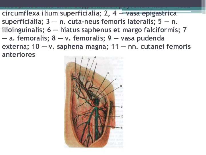 Поверхностные слои бедренного треугольника: I — vasa circumflexa ilium superficialia;