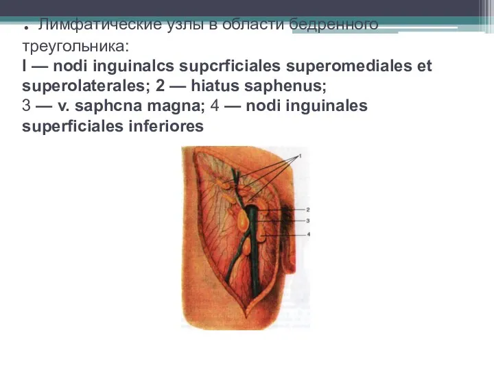 . Лимфатические узлы в области бедренного треугольника: l — nodi