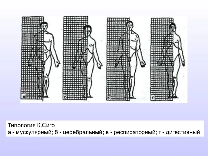 Типология К.Сиго а - мускулярный; б - церебральный; в - респираторный; г - дигестивный