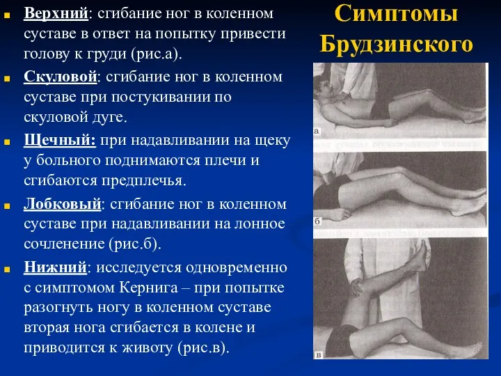 Симптомы Брудзинского Верхний: сгибание ног в коленном суставе в ответ на попытку привести