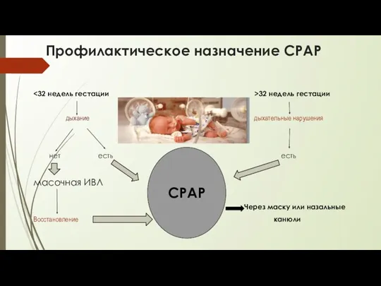 Профилактическое назначение СРАР 32 недель гестации дыхание дыхательные нарушения нет