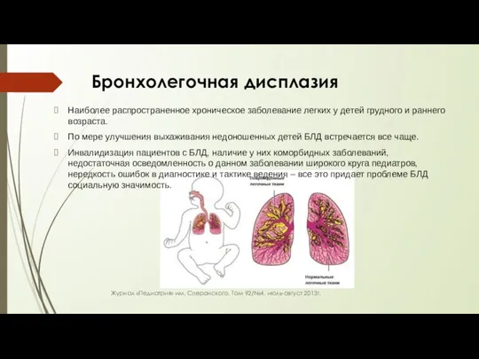 Бронхолегочная дисплазия Наиболее распространенное хроническое заболевание легких у детей грудного