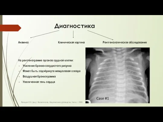 Диагностика Анамнез Клиническая картина Рентгенологическое обследование На рентгенограмме органов грудной