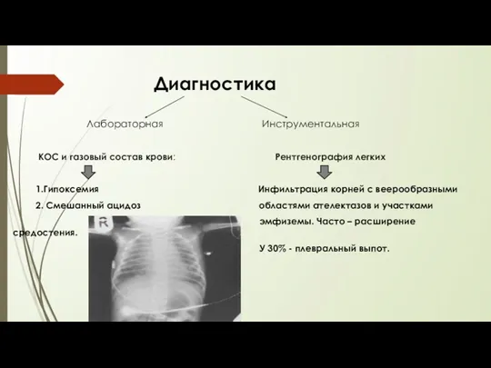 Диагностика Лабораторная Инструментальная КОС и газовый состав крови: Рентгенография легких