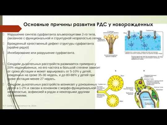 Основные причины развития РДС у новорожденных Нарушение синтеза сурфактанта альвеолоцитами