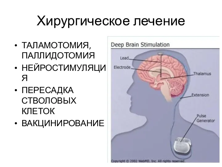 Хирургическое лечение ТАЛАМОТОМИЯ, ПАЛЛИДОТОМИЯ НЕЙРОСТИМУЛЯЦИЯ ПЕРЕСАДКА СТВОЛОВЫХ КЛЕТОК ВАКЦИНИРОВАНИЕ