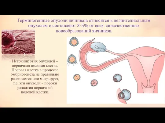 Герминогенные опухоли яичников относятся к неэпителиальным опухолям и составляют 3-5%